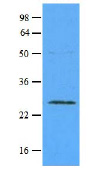Figure 1. MTP1 antibody staining of Formalin-Fixed Paraffin Embedded Human Skeletal Muscle.
