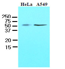 Figure 2. Antibody ( at 0.03ug/ml) staining of Mouse Brain lysate (35ug protein in RIPA buffer). Primary incubation was 1 hour. Detected by Chemiluminescence.