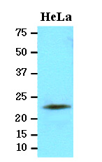 Antibody (1ug/ml) staining of Human Adipose lysate (35ug protein in RIPA buffer). Primary incubation was 1 hour. Detected by chemiluminescence.
