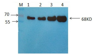 Western blot using Rabbit-anti-SAE1 pS185 antibody shows detection of phosphorylated SAE1. Left lane (-) contains 20ug human HeLa whole cell protein. Right lane (+) contains 20ug human HeLa whole cell protein from cells pre-treated with phosphatase inhibitor cocktail to prevent dephosphorylation of the target. Proteins were separated on a 10% SDS-PAGE and transferred onto nitrocellulose. After blocking with 5% milk-TBST 1 hr at room temperature, the membrane was probed with the primary antibody diluted to 1:1,000 at room temperature for 3 hr followed by washes and reaction with HRP-conjugated secondary and ECL imaging.