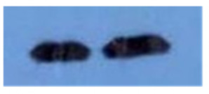 Western blot using Rabbit-anti-SAE1 pS185 antibody shows detection of phosphorylated SAE1. Left lane (-) contains 20ug human HeLa whole cell protein. Right lane (+) contains 20ug human HeLa whole cell protein from cells pre-treated with phosphatase inhibitor cocktail to prevent dephosphorylation of the target. Proteins were separated on a 10% SDS-PAGE and transferred onto nitrocellulose. After blocking with 5% milk-TBST 1 hr at room temperature, the membrane was probed with the primary antibody diluted to 1:1,000 at room temperature for 3 hr followed by washes and reaction with HRP-conjugated secondary and ECL imaging.