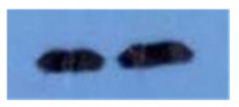 Western blot using affinity purified antip90 RSK1 pS732 antibody shows detection of a band ~90 kDa in size corresponding to phosphorylated p90 RSK1 (arrowhead) in EGF stimulated (lane 2) HEK293T cell lysates prepared from cells grown in the absence of serum for 12 h. No staining is observed in similarly prepared lysates derived from unstimulated (control) cells (lane 1). After transfer, the membrane was blocked overnight followed by reaction with the primary antibody at a 1:1,000 dilution. Detection occurred using a peroxidase conjugated secondary antibody and ECL.