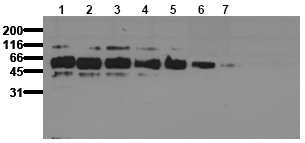 Antibody Sensitivity: Streptavidin (10ng/lane) was separated by non-reducing SDS-PAGE and transferred to PVDF membranes. Immunoblots were probed with AM20223PU-N Streptavidin antibody (Clone 36G3) for 1h at RT and developed by ECL (exp. time: 30 sec). Lane