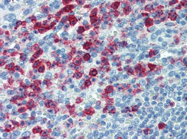 IHC Image of AM20569PU-N: Human Spleen: Formalin-Fixed, Paraffin-Embedded (FFPE)