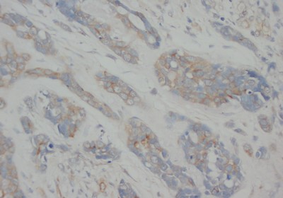 alpha Tubulin (TUBA1A) Mouse Monoclonal Antibody [Clone ID: Tub-1]