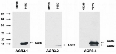 Western blotting analysis of AGR3 protein by AGR3.1 and AGR3.2 antibody, and of AGR3 and AGR2 protein by AGR3.4 antibody in T47D breast cancer cell line compared to H1229 lung carcinoma cell line.