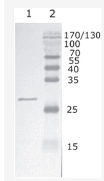 Figure 1: Western Blot testing of HIV-1 recombinant Rev protein. using HIV-1 Rev antibody, clone 1. Line 1. RecombinantHIV-1 Rev (B subtype) Line 2. Protein size marker