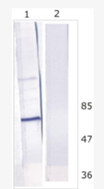 Western Blot analysis of Huh-7 cell line expressing NS5B protein. Detected by 9A2 antibody. Line 1. Huh-7 transfected with HCV replicon, Line 2. Huh-7 non-transfected cells.