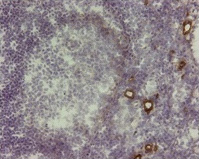 Immunohistochemical analysis of VAP-1 on human tonsil tissue. Staining of frozen tissue section with antibody 174-5. Anti-human VAP-1 staining results in vessels that are VAP-1 positive, whereas morphologically similar vessels next to positive ones can be negative.