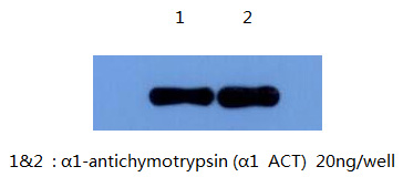 Detect alpha1 antichymotrypsin using antibody B5B11 at 1:5000 dilution.