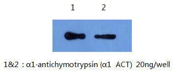 Detect alpha1 antichymotrypsin using antibody B7B10 at 1:5000 (0.2microng/ml) dilution.