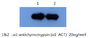 Detect alpha1 antichymotrypsin using antibody B7H2 at 1:5000 (0.2ug/ml) dilution.