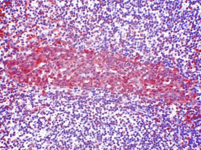 Immunohistochemistry on paraffin sections: Staining with AM26722PU-N on Human tonsil.