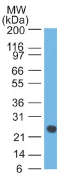 Western blot analysis of Lambda in Human intestine using Lambda Antibody Cat.-No AM32823PU (CloneLcN-2).