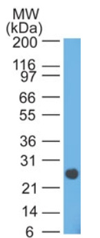 Western blot analysis of Lambda in Human intestine using Lambda Antibody Cat.-No AM32827PU (Clone HP6054).