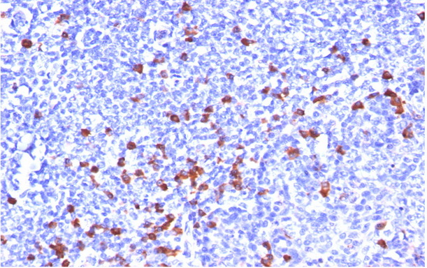 Western blot analysis of TTR Antibody (Center) in HepG2 cell line lysates (35ug/lane). TTR (arrow) was detected using the purified Pab.