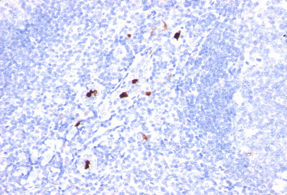 Formalin-Fixed, Paraffin-Embedded tonsil stained with Myeloid specific antigen Antibody Cat.-No AM33284PU (Clone SPM298). Formalin-Fixed, Paraffin-Embedded tonsil stained with Myeloid specific antigen Antibody Cat.-No AM33284PU (Clone SPM298).