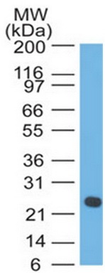 Western blot analysis of Lambda Light Chain in human intestine using Lambda Light ChainAntibody Cat.-No AM33321PU (Clone LcN-2+ICO-106).