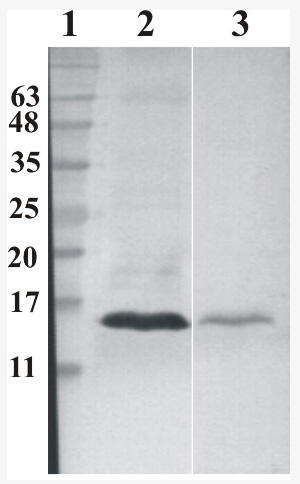 Western Blot analysis of RNase 7 antibody 3C2. Human RNase 7 was expressed by CHOEBNALT85 cell line. 10 microl of cell culture supernatant was loaded per line. Line 1: Prestained Protein Ladder, Naxo 8003; Line 2: non-reduced conditions; Line 3: Reduced conditions