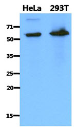 Western blot analysis of DMPK antibody (Cat.-No.: AP20433PU-N) in extracts from Jurkat cell.
