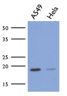 Western blot (WB) analysis of MRCKβ antibody (Cat.-No.: AP20465PU-N) in extracts from COLO cell.