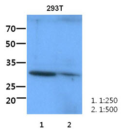 Western blot analysis of CD117/c-Kit antibody at 1/500 dilution in: Lane 1 : MCF-7 cell lysate. Lane 2 : sp2/0 cell lysate. Lane 3 : NIH-3T3 cell lysate.