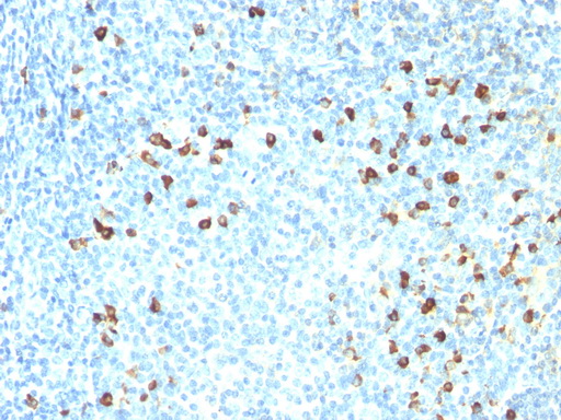 Formalin-Fixed, Paraffin-Embedded Human tonsil stained with Kappa Light Chain Antibody Cat.-No AM50120PU (Clone SPM558). Note cell membrane & cytoplasmic staining.