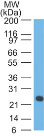 Western blot analysis of Lambda Light Chain in human intestine using Human Lambda Light Chain Antibody Cat.-No AM50121PU (Clone SPM559).