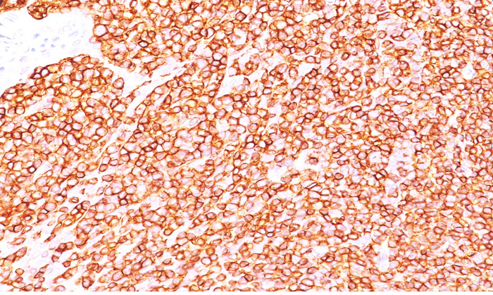 Formalin-Fixed, Paraffin-Embedded Human tonsil stained with CD45RB Antibody (Clone BRA-11).