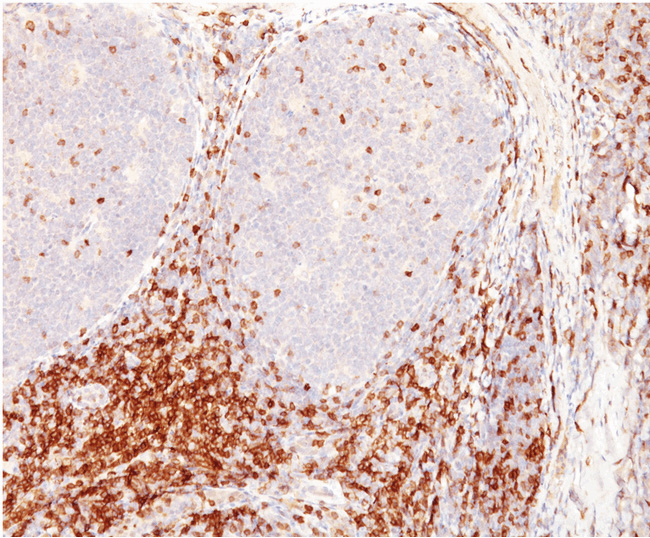 Formalin-Fixed, Paraffin-Embedded Human tonsil stained with CD5 Antibody (Clone CD5/54/F6)