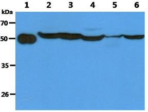 The Recombinant Human TBCEL (50ng) and Cell lysates (40ug) were resolved by SDS-PAGE, transferred to PVDF membrane and probed with anti-human TBCEL antibody (1:1000). Proteins were visualized using a goat anti-mouse secondary antibody conjugated to HRP and an ECL detection system. Lane 1.: Recombinant Human TBCEL Lane 2.: PC3 cell lysate Lane 3.: LNCap cell lysate Lane 4 : 293T cell lysate Lane 5.: Mouse testis lysate Lane 6.: Mouse Kidney lysate