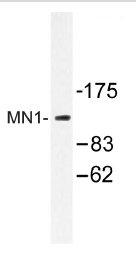 Western blot (WB) analysis of MN1 antibody in extracts from COLO.