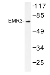 Western blot (WB) analysis of EMR3 antibody in extracts from Jurkat cells.