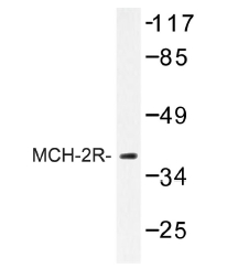 Western blot (WB) analysis of MCH-2R antibody in extracts from HUVEC cells.