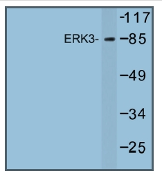 Western blot (WB) analysis of ERK3 antibody in extracts from K562 cells.