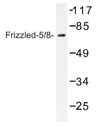 Western blot analysis with extracts from Jurkat cells using FZD5/FZD8 antibody (Cat.-No. AP01257PU-N).