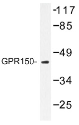 Western blot (WB) analysis of GPR150 antibody in extracts from J HUVEC cells.
