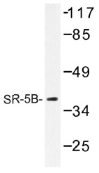 Western blot (WB) analysis of SR-5B antibody in extracts from COLO cells.