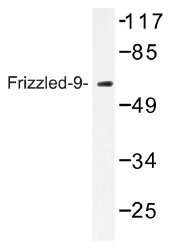 Western blot (WB) analysis of Frizzled-9 antibody in extracts from HUVEC cells.