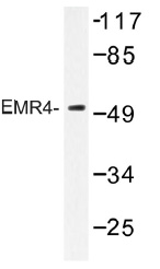 Western blot (WB) analysis of EMR4 antibody (Cat.-No.: AP01313PU-N) in extracts from HUVEC cells.