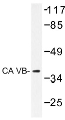 Western blot (WB) analysis of CA VB antibody (Cat.-No.: AP01389PU-N) in extracts from 3T3 cells.