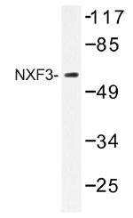 Western blot (WB) analysis of NXF3 antibody (Cat.-No.: AP01412PU-N) in extracts from MCF-7 cells.