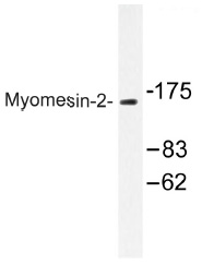 Western blot (WB) analysis of Myomesin-2 antibody in extracts from COS-7 cells.