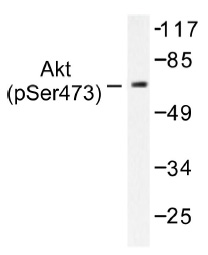 Western blot (WB) analysis of p-Akt antibody (Cat.-No.: AP01520PU-N) in extracts from 293 cells treated with TNF-a 20ng/ml 30.