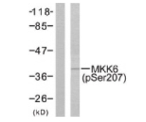 Western blot (WB) analysis of MKK6 pSer207 antibody in extracts from MDA-MB-435 cells treated with UV.
