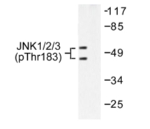 Western blot analysis of JNK1/2/3 (pThr183+Tyr185) antibody (Cat.-No.: AP01893PU-N) in extracts from 293 cells treated with UV, 5mins.