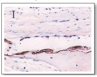 Immunohistochemical analysis of paraffin embedded rat tissue sections (cardiac muscle) using CRP antibody