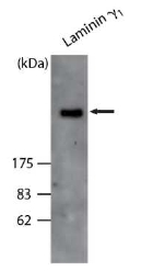 NQO1 antibody staining of Human Kidney lysate at 0.3ug/ml (35ug protein in RIPA buffer). Primary incubation was 1 hour. Detected by chemiluminescence.