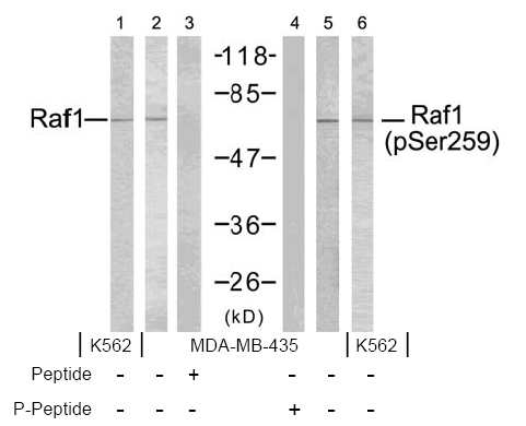 Antibody (0.05ug/ml) staining of Daudi lysate (35ug protein in RIPA buffer). Primary incubation was 1 hour. Detected by chemiluminescence.