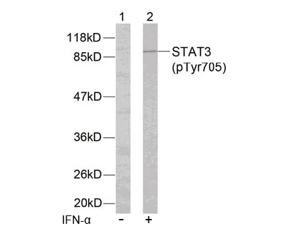 Western Blot Analysis using a Protein-A purified antibody against svVEGF-F (Bothrops Insularis). Recombinant svVEGF-F produced in E. coli was used for immunization. The antibody detects the monomeric svVEGF-F but shows no cross reactivity with related prot